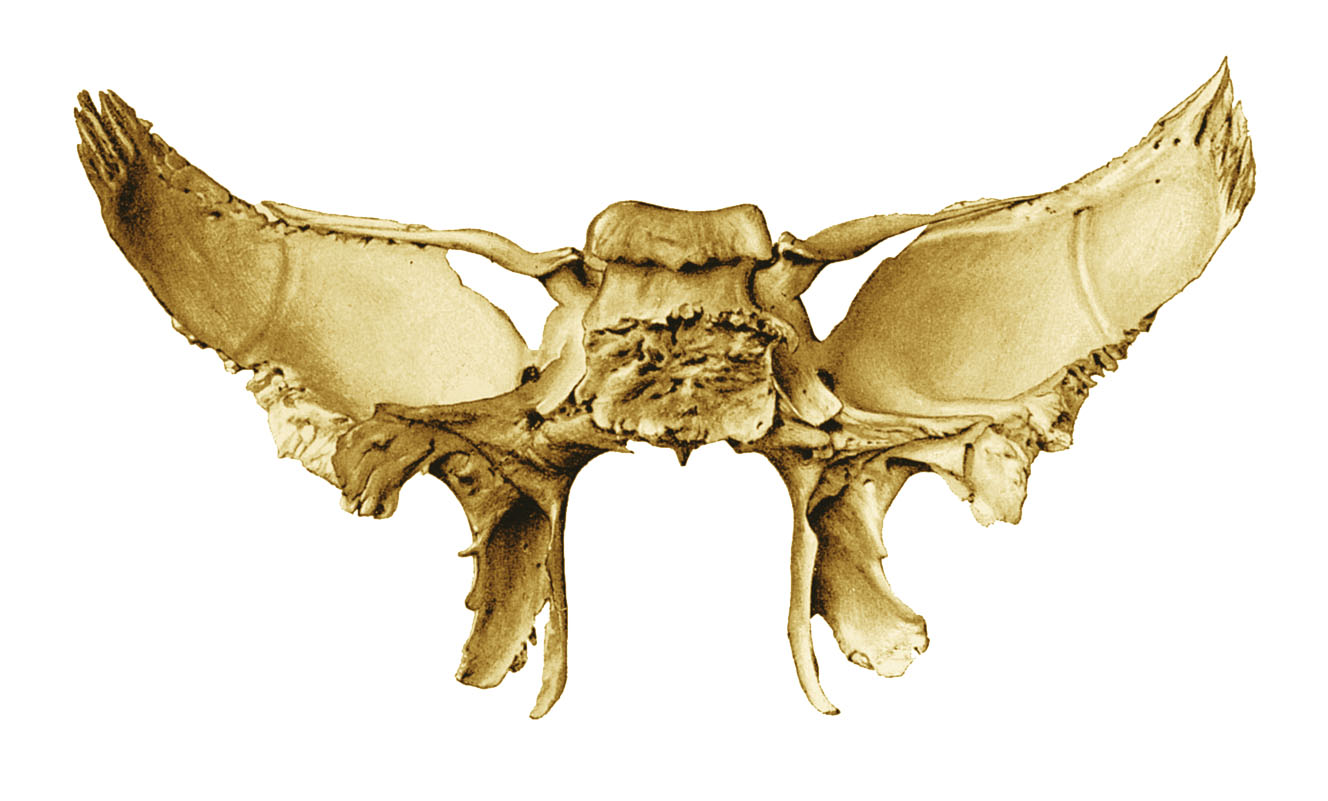anatomyEXPERT - Anterior clinoid process of the sphenoid bone